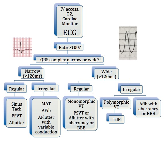 Arrhythmia Recognition Chart